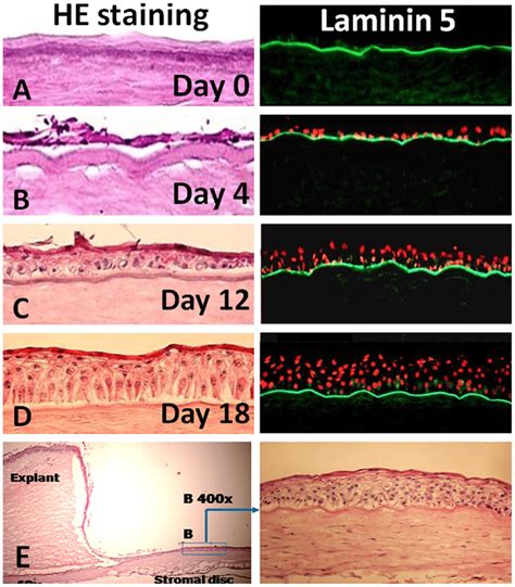 Growth Of Limbal Epithelial Cells On Corneal Stroma A The