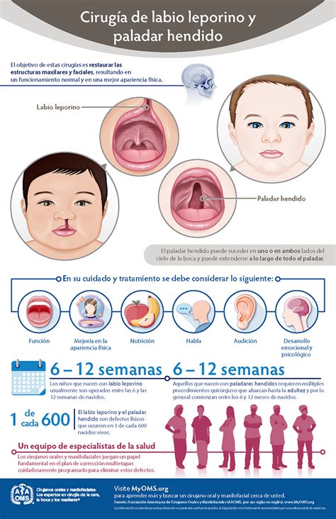 Cleft Lip Surgery Is Usually Performed By The Time An Infant Is 3