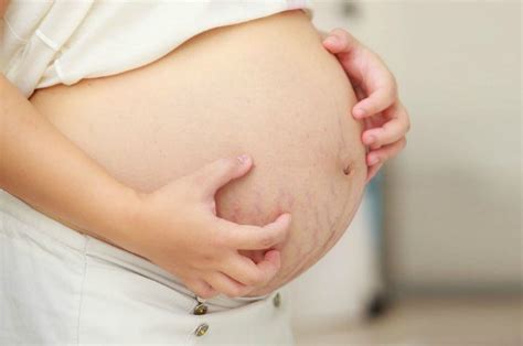 Gatal Di Kulit Saat Kehamilan Membuat Bumil Tidak Nyaman