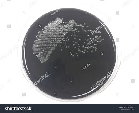 Стоковая фотография 1252356415 Campylobacter Jejuni Colony Morphology