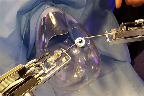 Robot Surgeon Can Slice Eyes Finely Enough To Remove Cataracts New