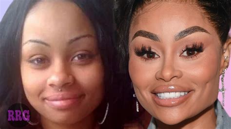 The Real Reason Blac Chyna Is Removing Her Plastic Surgery Youtube