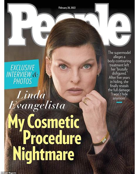 Linda Evangelista Seen For First Time Since Revealing Her Deformed