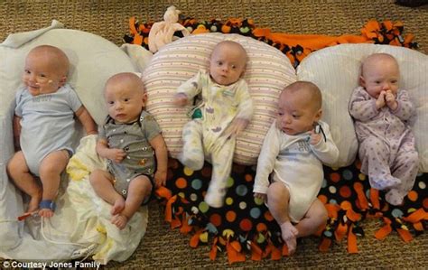 Miracle Quintuplets Reunited At Home For The First Time After Smallest