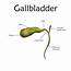 Signs You Have Gallbladder Issues & What To Do About It  Neumann
