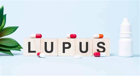 Sistemski Eritemski Lupus Uzrok Simptomi Lije Enje Arz Hr