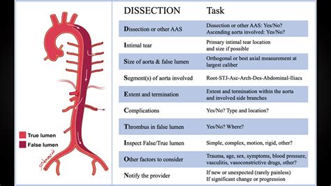 Abdominal Aorta Branches Mnemonic