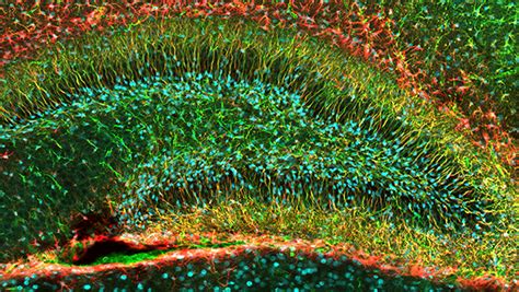 Look Inside The Dentate Gyrus