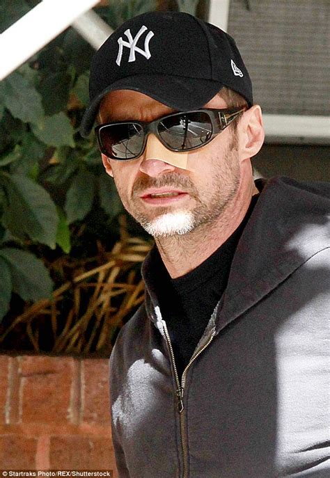 Hugh Jackman Has A 6th Skin Cancer Cut Out From His Nose Daily Mail