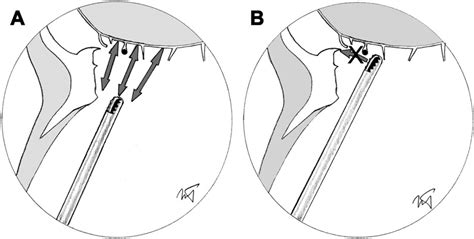 A Diagram Of The Nasal Cavity In Sagittal View Depicting The Proper