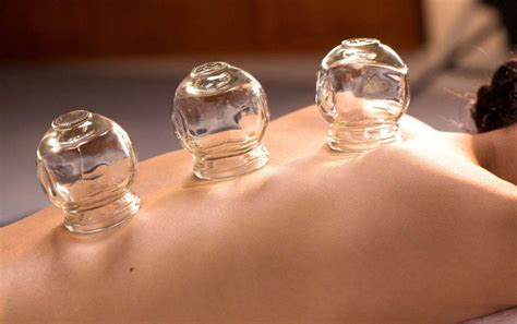 Cupping Massage Clinic Near Me Cupping Therapy Gold Coast