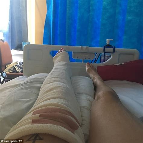 Broadchurch Actress Sarah Parish Shatters Her Leg Using Sledge Daily