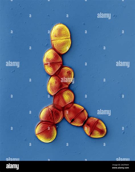Streptococcus Pneumoniae Color Micrografía De Electrones De