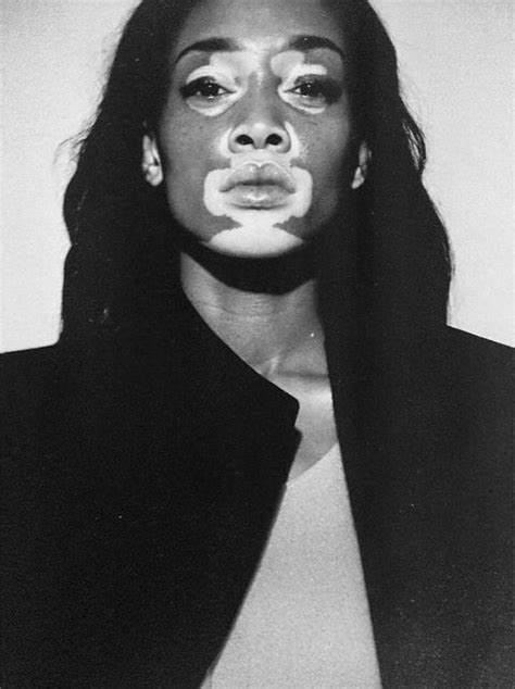 The6godess Winnie Harlow Chantelle Brown Young Model