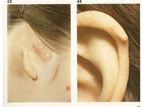 Solution Diseases Of External Ears Studypool