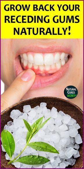 Home Remedies For Gum Disease Healthy Lifestyle