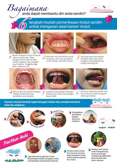 Self Check Oral Cancer Malaysian Dental Association