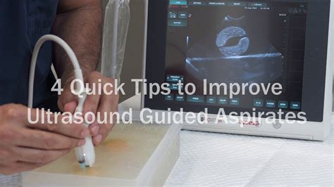 4 Quick Tips To Improve Ultrasound Guided Aspirates Youtube