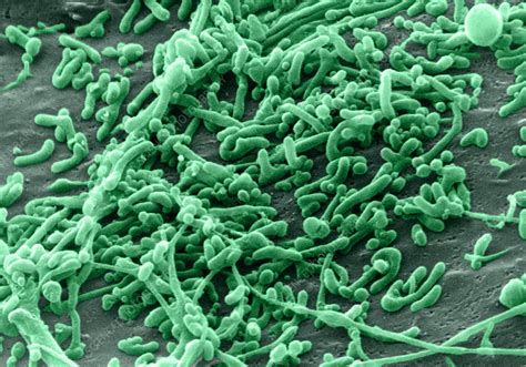 Mycoplasma Bacteria Sem Stock Image C0282515 Science Photo Library