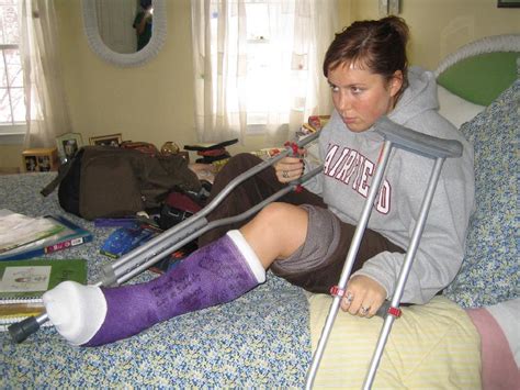 Shortdlizzy Broken Leg Ankle Foot Cast Crutches Sock Cb777a Flickr
