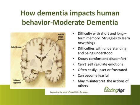 Ppt Improving Dementia Care Reducing Unnecessary Antipsychotic
