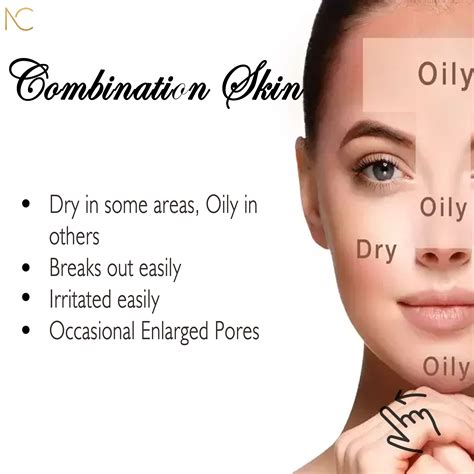 Combination Skin Combination Skin Oily Skin Skin