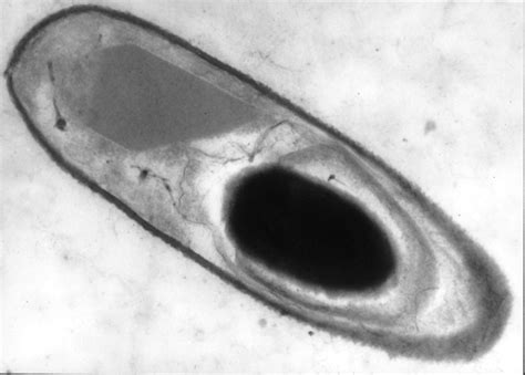 Bacillus Thuringiensis Come Si Usa Sanodhi