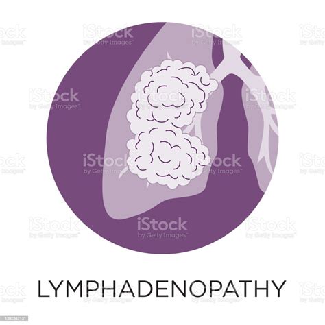Lymphadenopathy Flat Style Vector Illustration In Circle Layout With