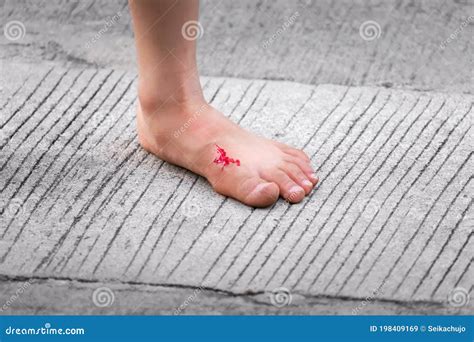 Injured Bleeding Child`s Bare Foot On Cement Surface Stock Image