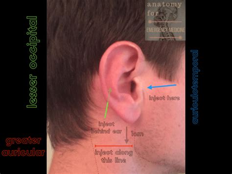 045 Sensory Innervation Of The Ear Anatomy For Emergency Medicine Podcast