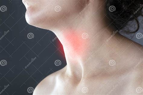 Sore Throat Allergy Flu Cold Angina Inflamed Lymph Nodes Stock Image