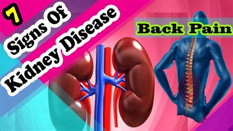 10 Signs And Symptoms Of Kidney Disease You Should Not Ignore