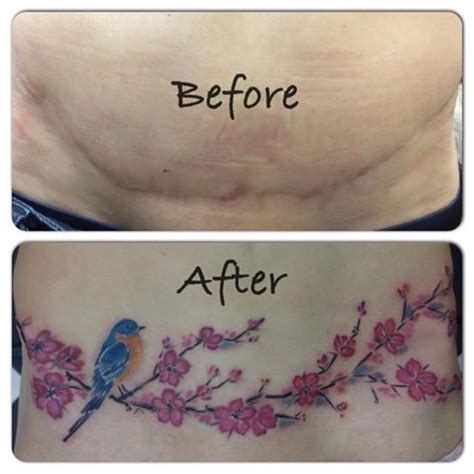 With this in mind, you have to realize beforehand that it's not a guarantee that the tattoo will meet your expectations. 14 Beautiful C-Section Scar Coverup Tattoos | Tattoos ...