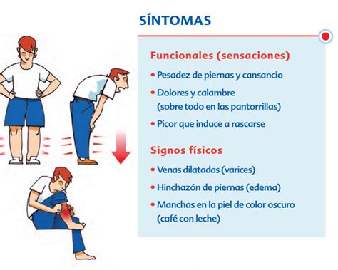 Consejos Para Problemas De CirculaciÓn En Las Piernas Centro De