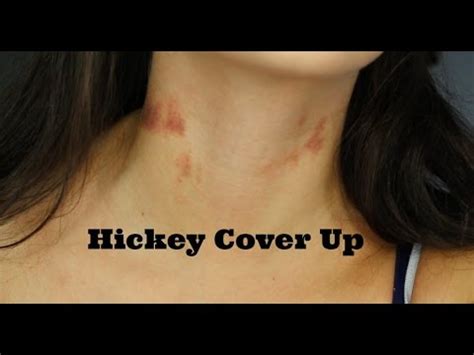 This could be the only web page dedicated to explaining the meaning of hickey (hickey acronym/abbreviation/slang word). How To: Cover up hickeys! - YouTube
