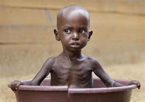 Report More Africans Suffering From Hunger Malnutrition Chimpreports