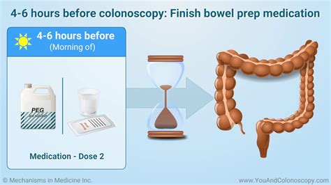 What Is A Colonoscopy And How Do I Prepare For It Youtube