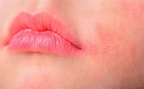 What To Do After An Allergic Reaction To Makeup