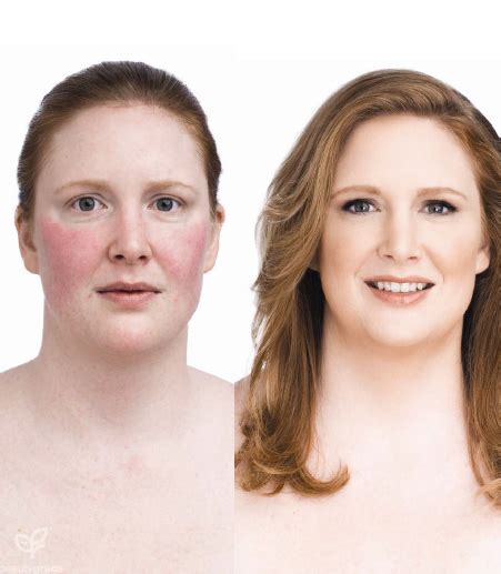 Jane Iredale Before And After Photos Beauty Grace