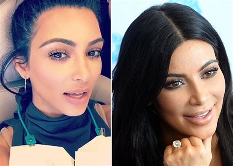 Oh No Kim Kardashian Has Only Gone And Chipped Her Pearly Whites