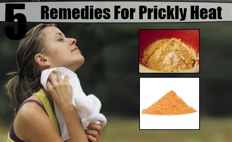 5 Effective Home Remedies For Prickly Heat Natural Home Remedies