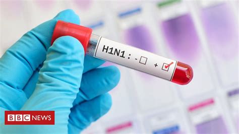 Por Que O H1n1 Não Parou Economias Como A Pandemia De Coronavírus