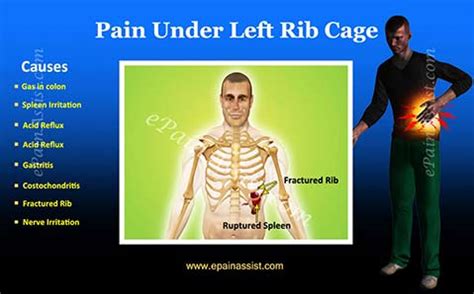 Broken ribs, shingles, trauma and breast pain are some of the possible causes of chest. Pain Under Left Rib Cage | Treatment | Causes | Diagnosis