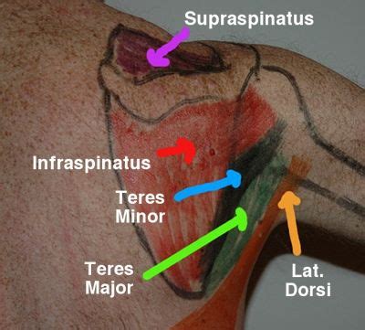 The tendon of the infraspinatus passes posteriorly on to the. posterior shoulder muscles, for those of us who are visual ...