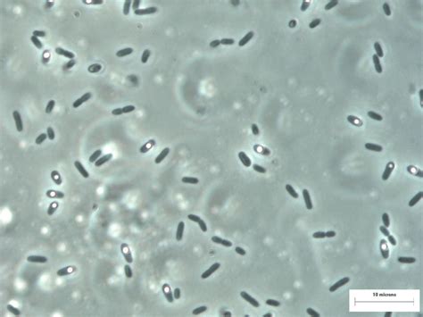 Fig S1 Endospore Formation In Solibacillus Kalamii Issfr 015 T