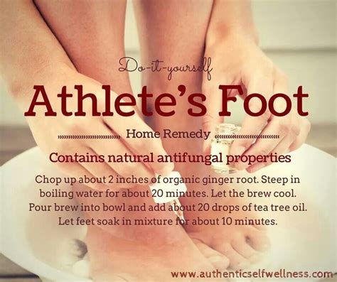 Pin By Marie Prinsloo On Health Athletes Foot Foot Remedies