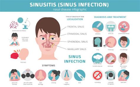 Signs And Symptoms Of Sinus Infection Pathkind