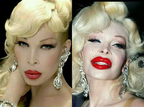 Before And After Pics Of 10 Hollywood Celebrities Having Plastic