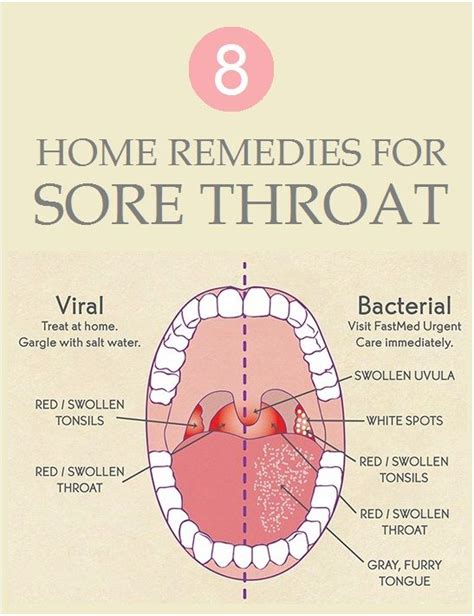 8 Best Home Remedies For Sore Throat A Z About Herbal Medicine