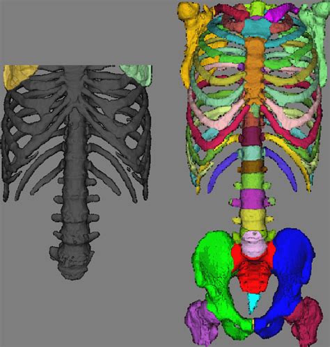 An Example Of Recognition Results Of The Bone Structures In Torso Ct